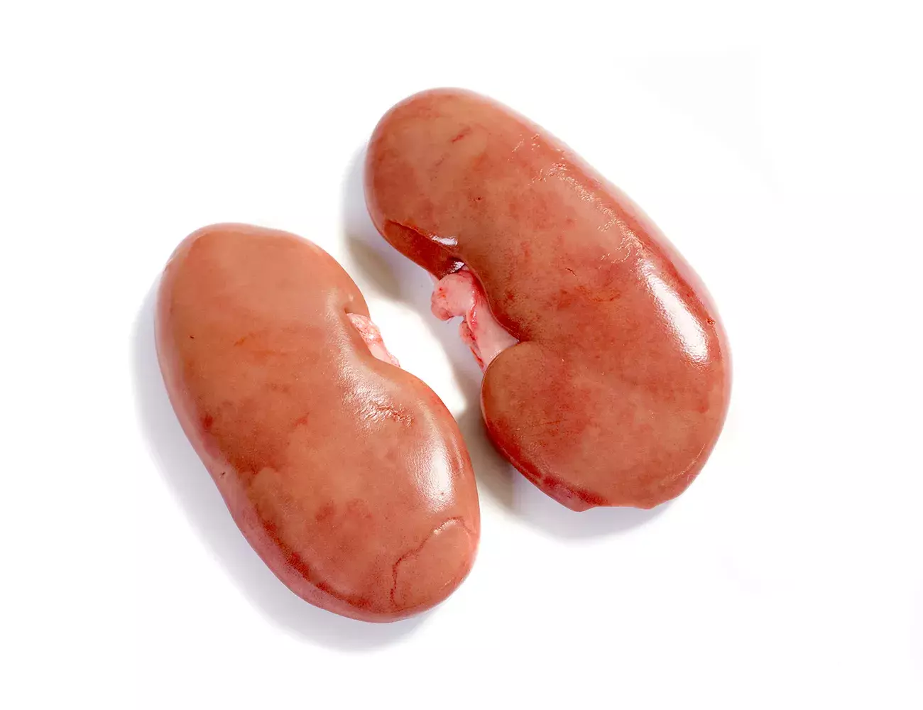 Riñones