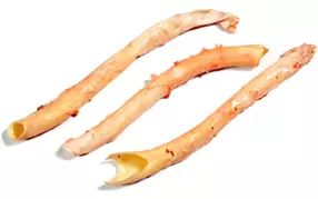 Aorta